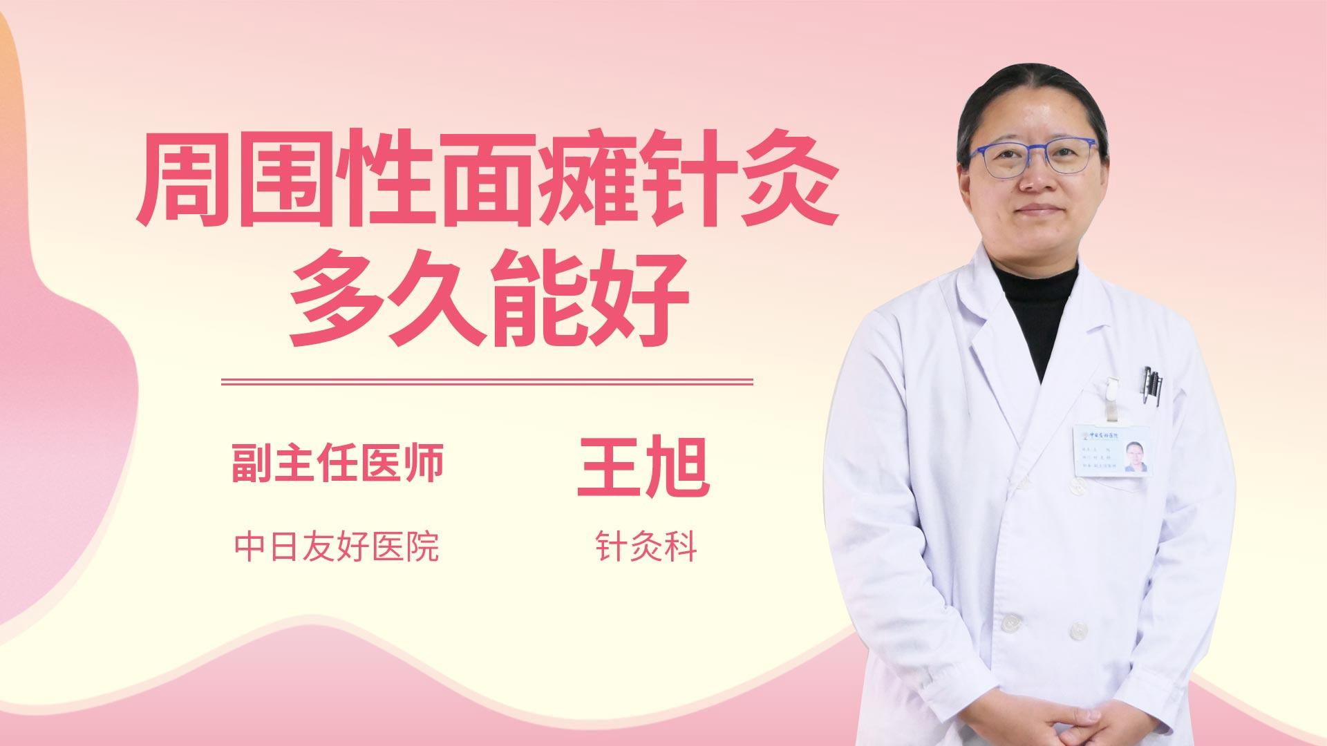 周围性面瘫针灸多久能好