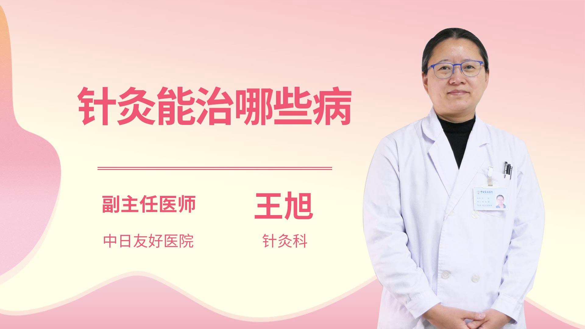 针灸能治哪些病