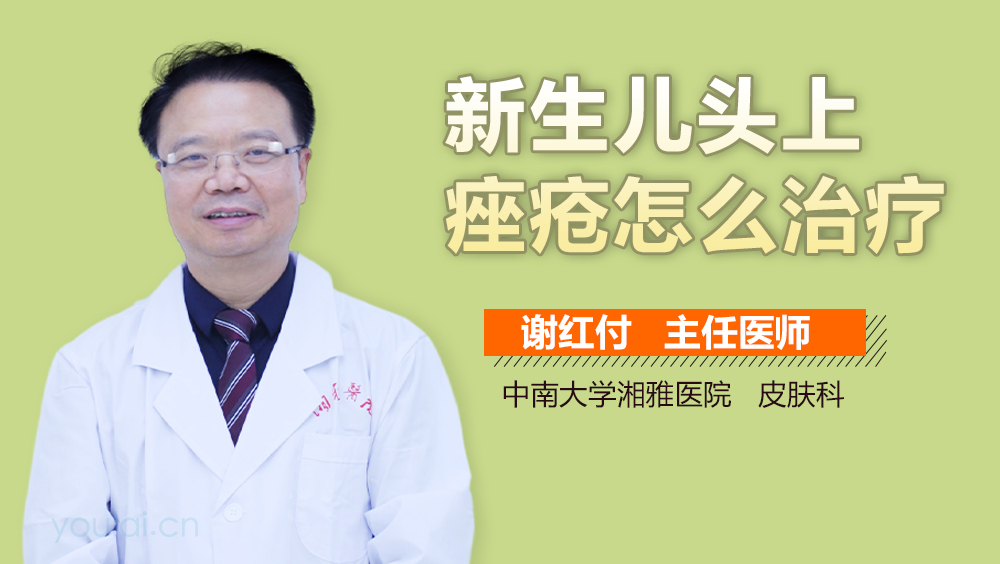 新生儿头上痤疮怎么治疗