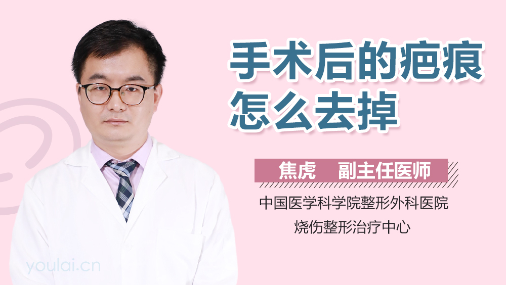 手术后的疤痕怎么去掉