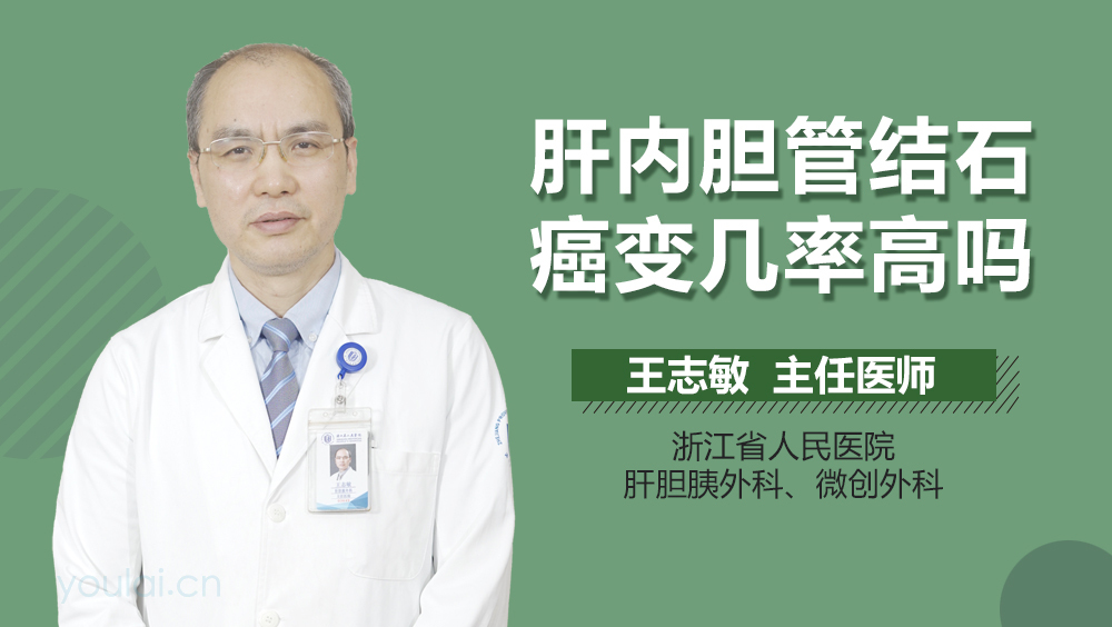 肝内胆管结石癌变几率高吗