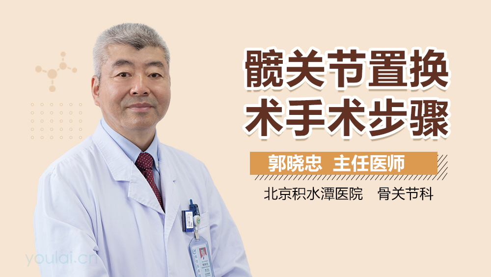 髋关节置换术手术步骤