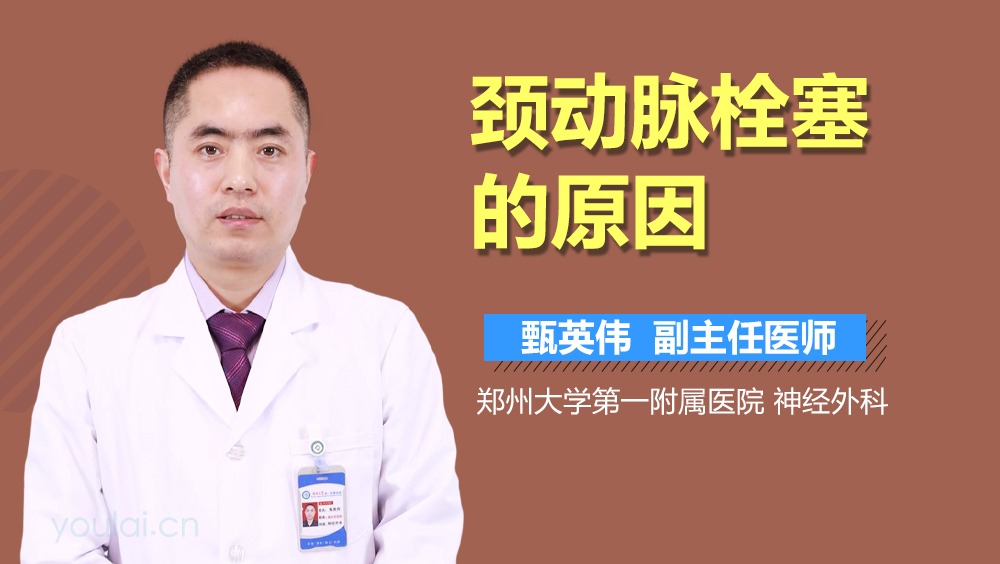 颈动脉栓塞的原因