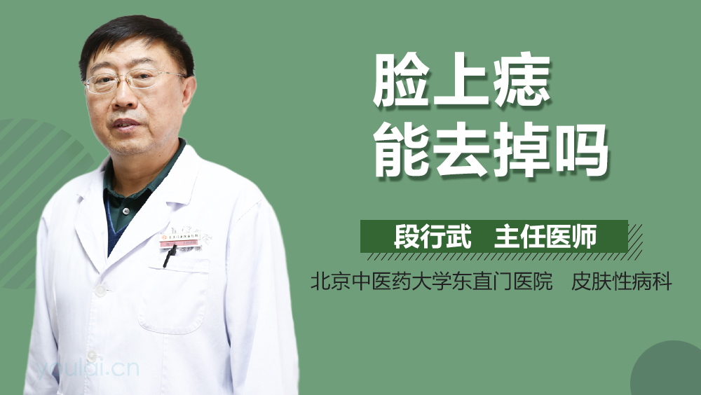 脸上痣能去掉吗