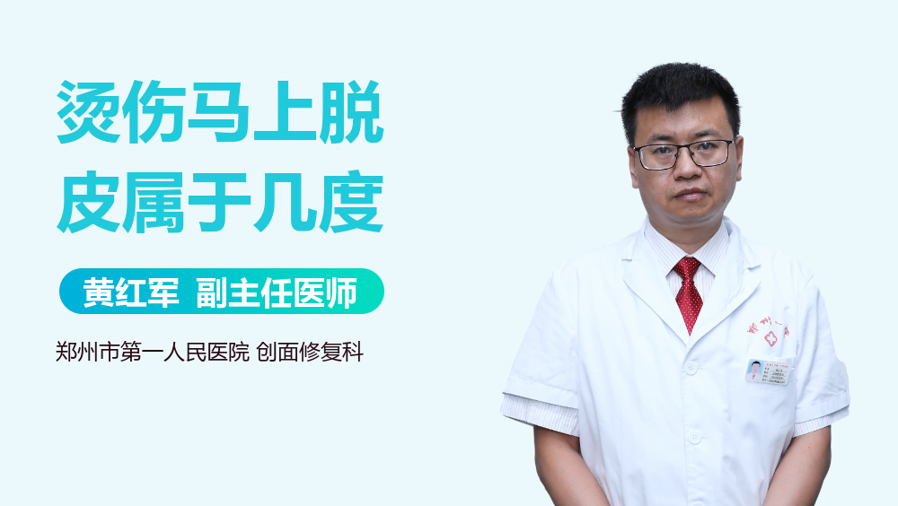 烫伤马上脱皮属于几度