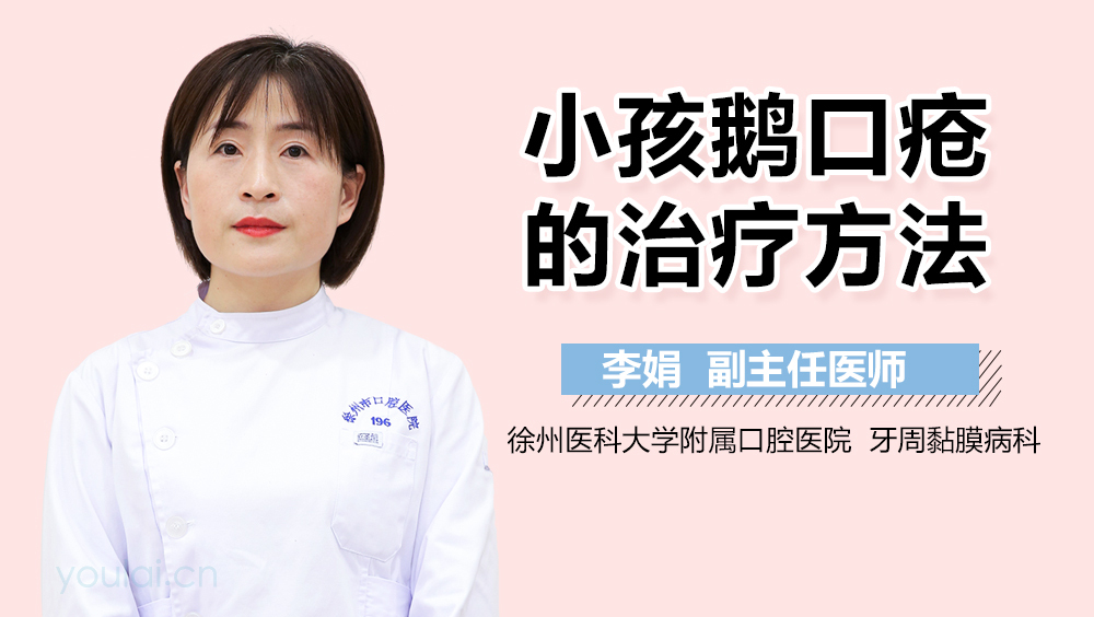 小孩鹅口疮的治疗方法