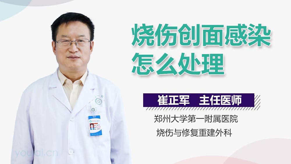 烧伤创面感染怎么处理