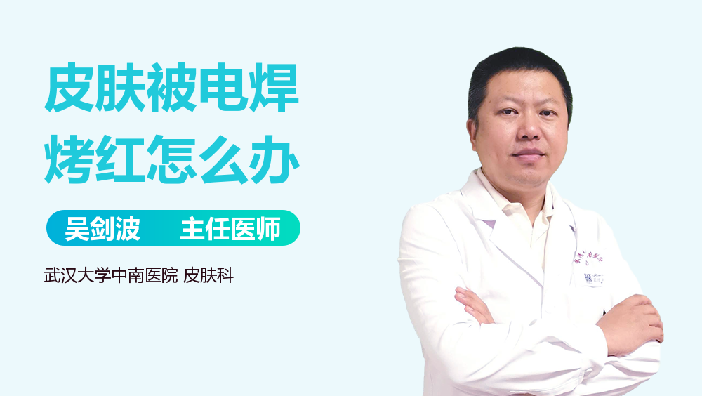 皮肤被电焊烤红怎么办