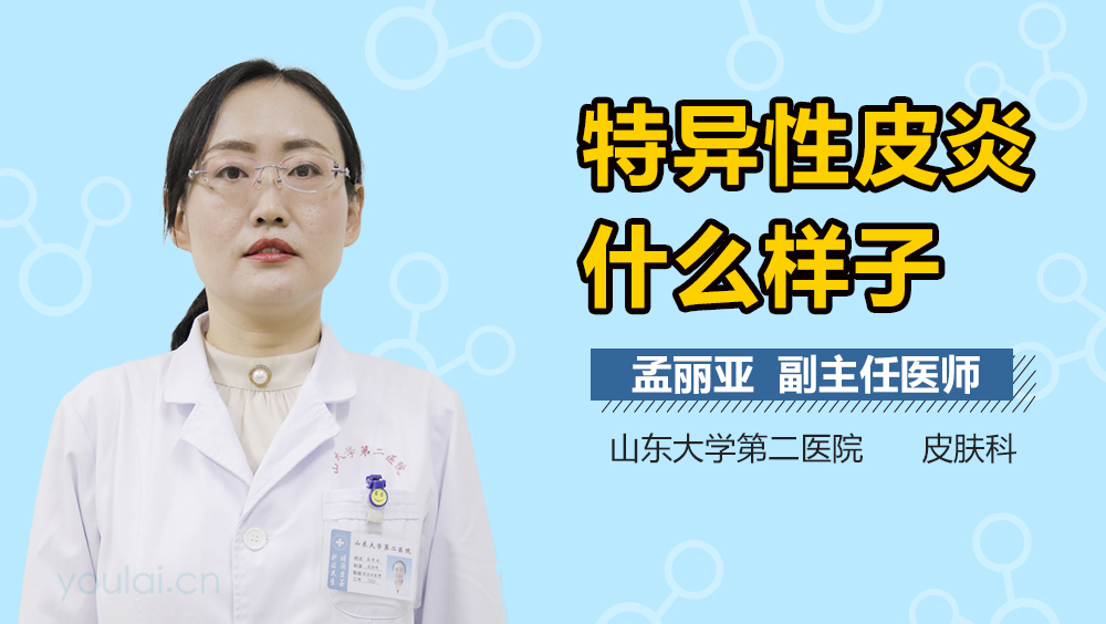 特应性皮炎什么样子