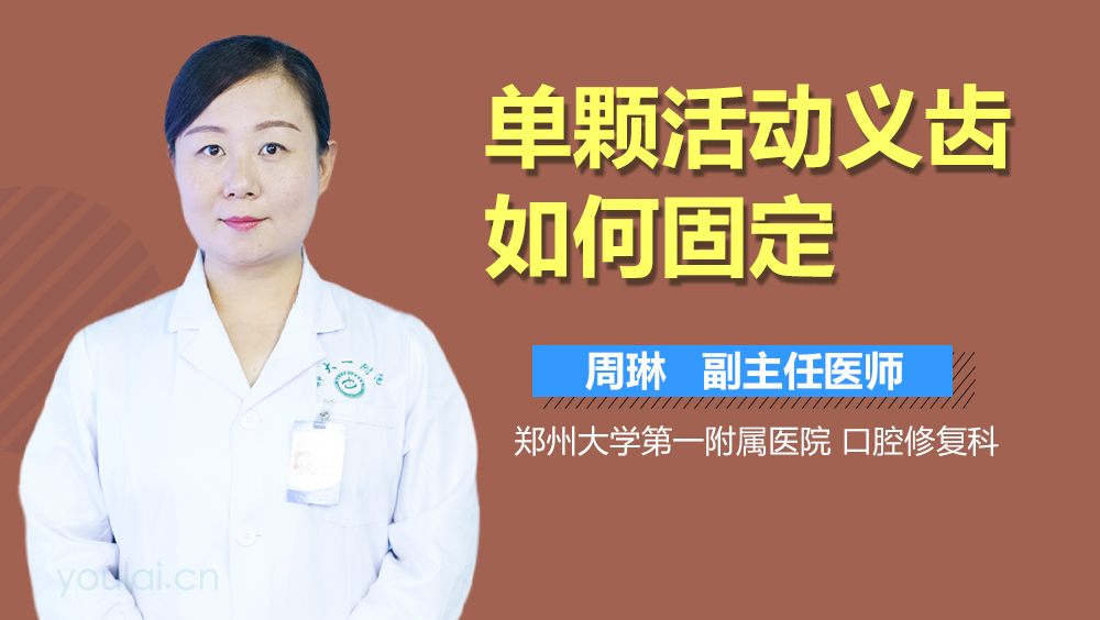 单颗活动义齿如何固定