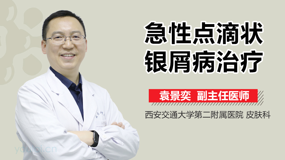 急性点滴状银屑病治疗