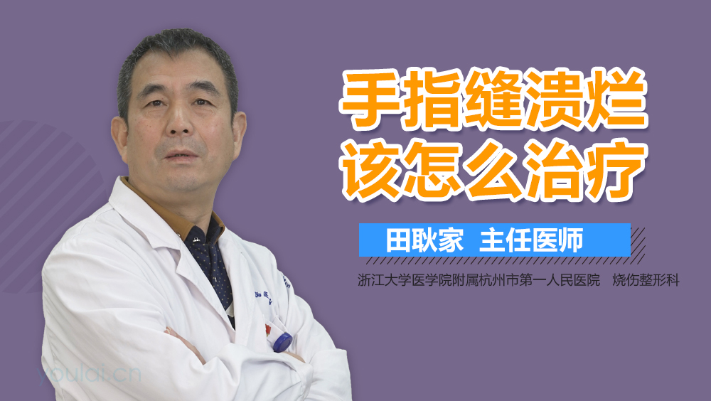手指缝溃烂该怎么治疗