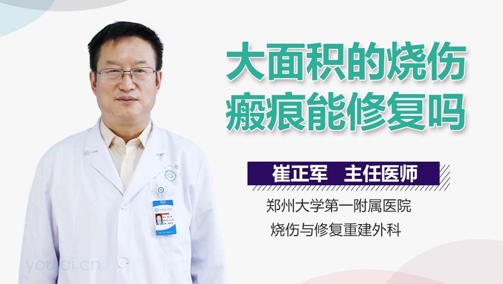 大面积的烧伤瘢痕能修复吗