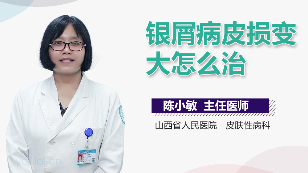 银屑病皮损变大怎么治