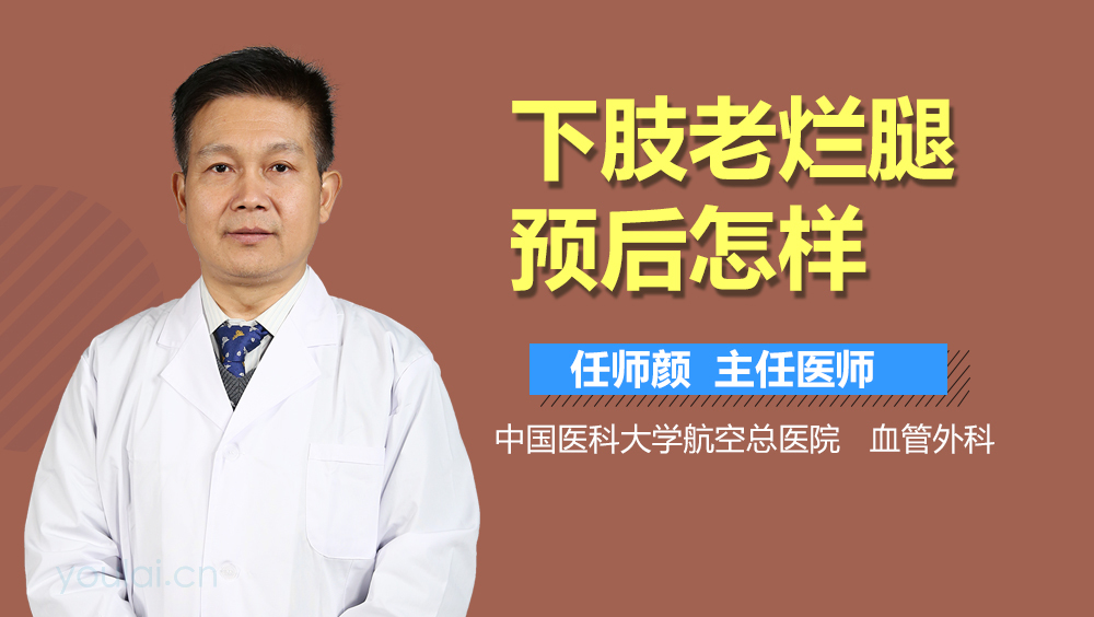 下肢老烂腿预后怎样