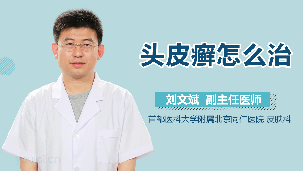 头皮癣怎么治