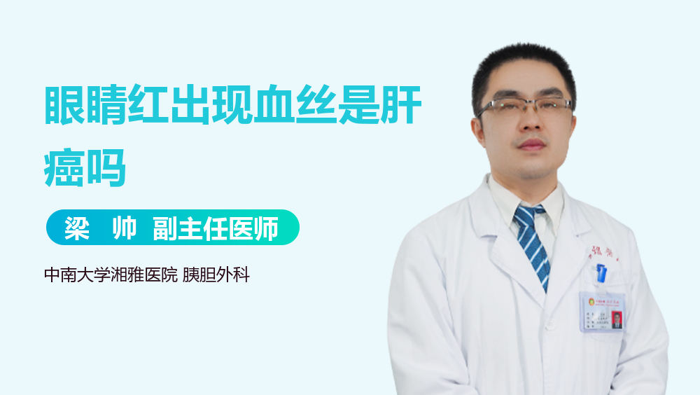 眼睛红出现血丝是肝癌吗