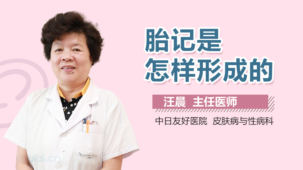 胎记是怎样形成的