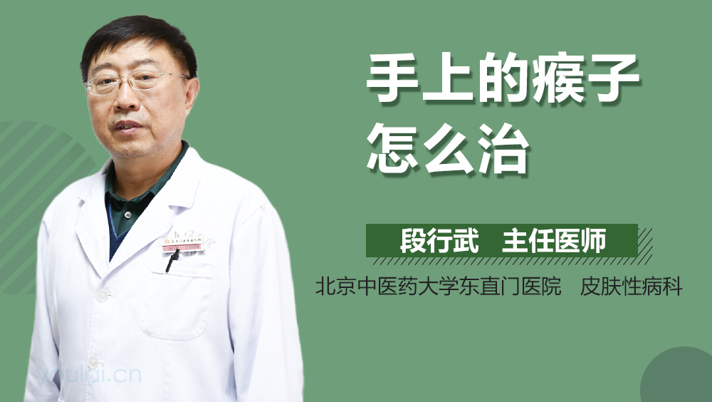 手上的瘊子怎么治