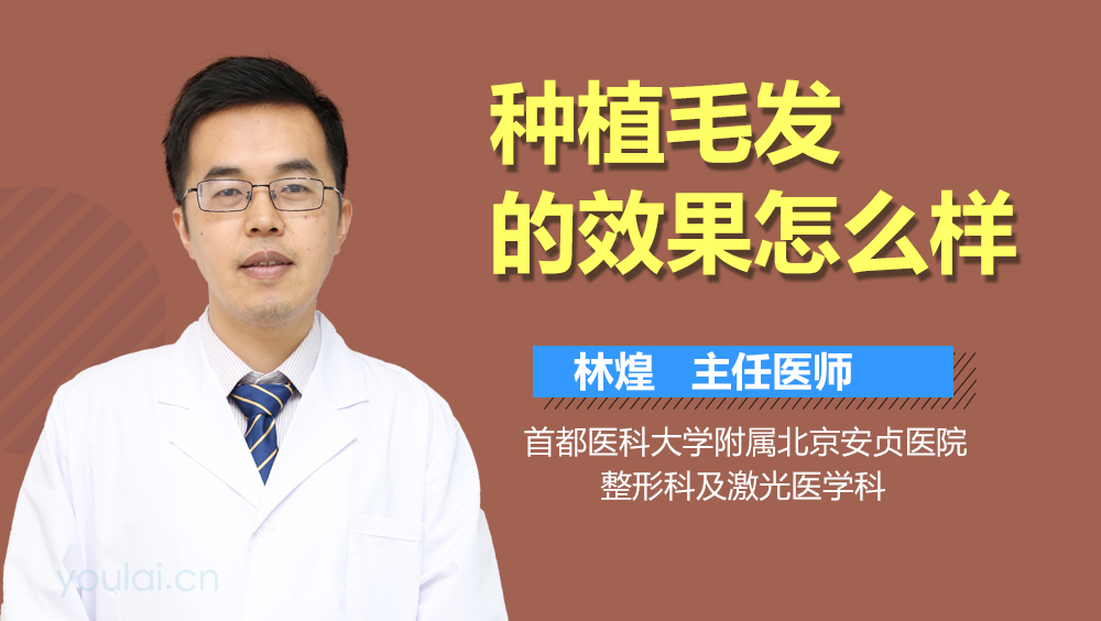 种植毛发的效果怎么样