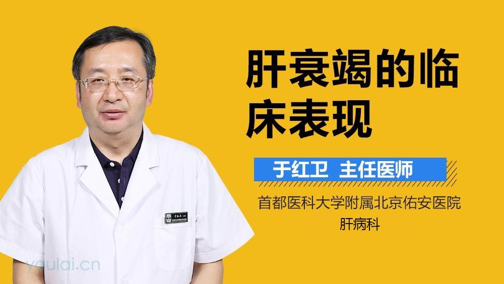 肝衰竭的临床表现