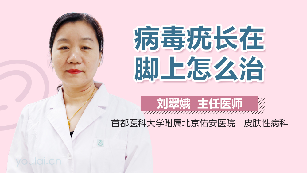 病毒疣长在脚上怎么治