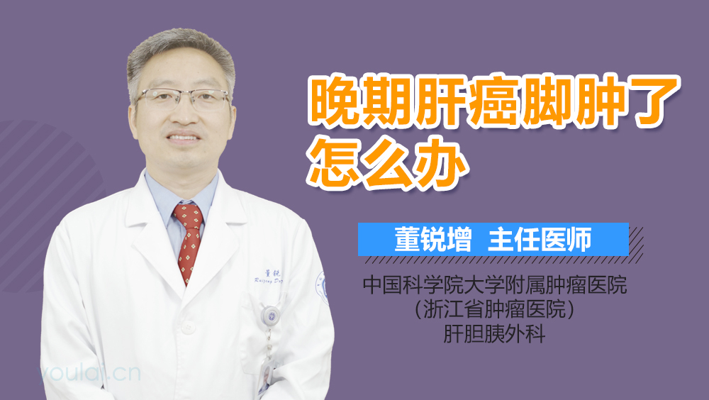 晚期肝癌脚肿了怎么办