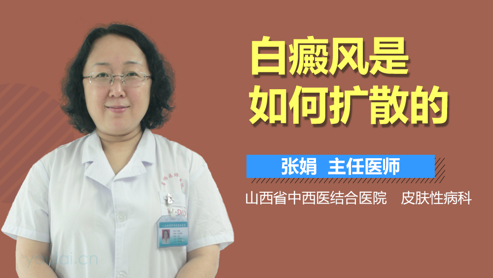 白癜风是如何扩散的