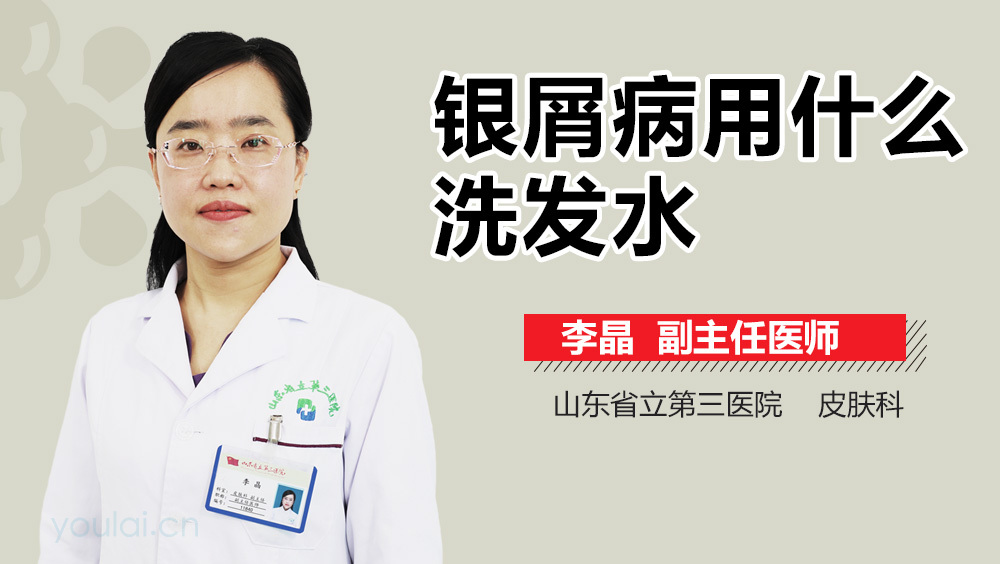银屑病用什么洗发水