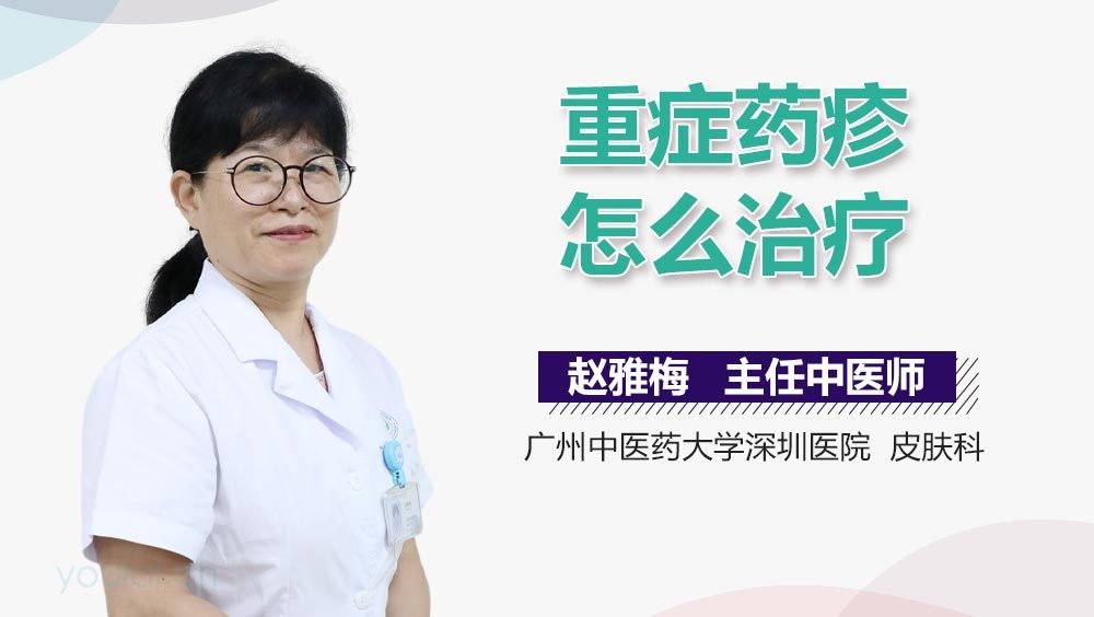 重症药疹怎么治疗