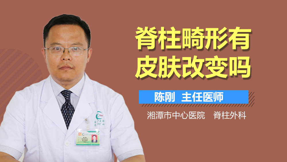 脊柱畸形有皮肤改变吗