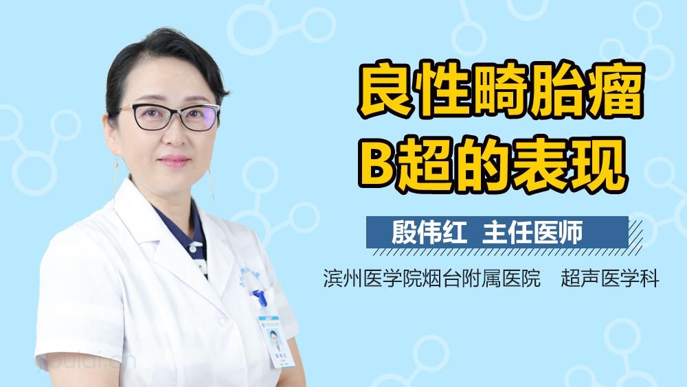 良性畸胎瘤B超的表现