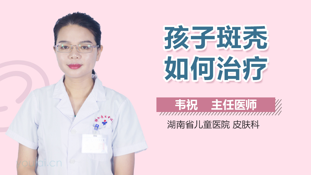 孩子斑秃如何治疗