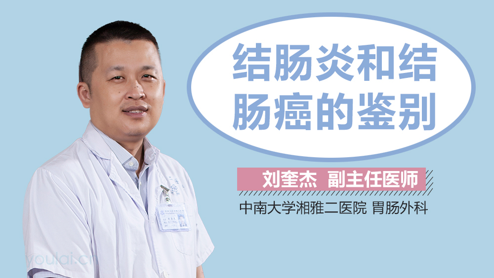 结肠炎和结肠癌的鉴别