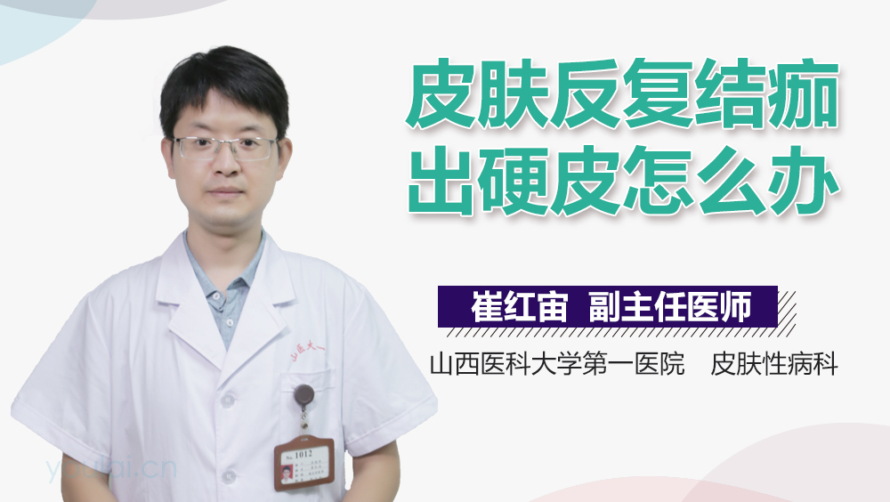 皮肤反复结痂出硬皮怎么办
