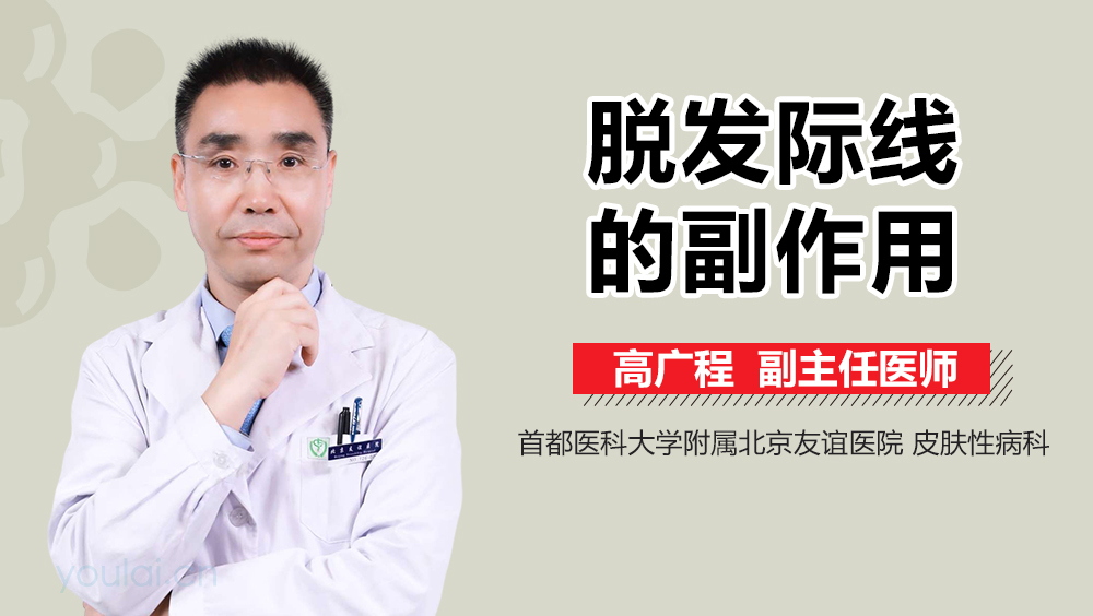 脱发际线的副作用