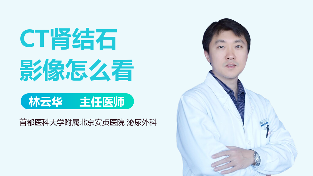 CT肾结石影像怎么看