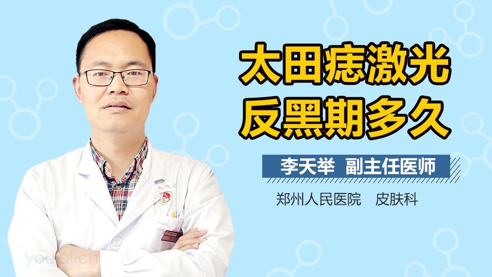 太田痣激光反黑期多久
