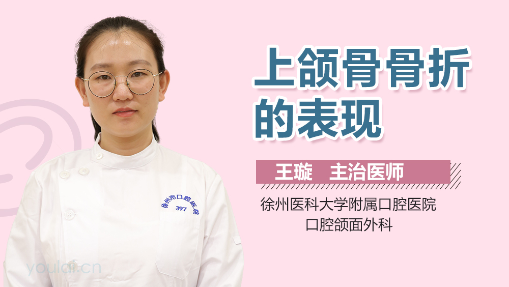 上颌骨骨折的表现