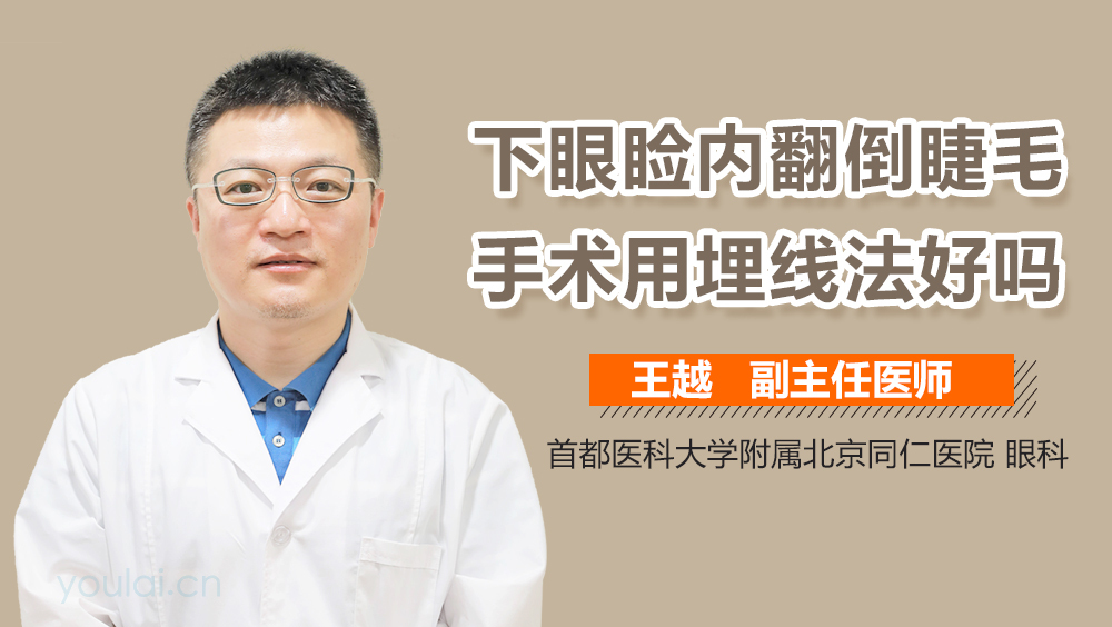 下眼睑内翻倒睫毛手术用埋线法好吗