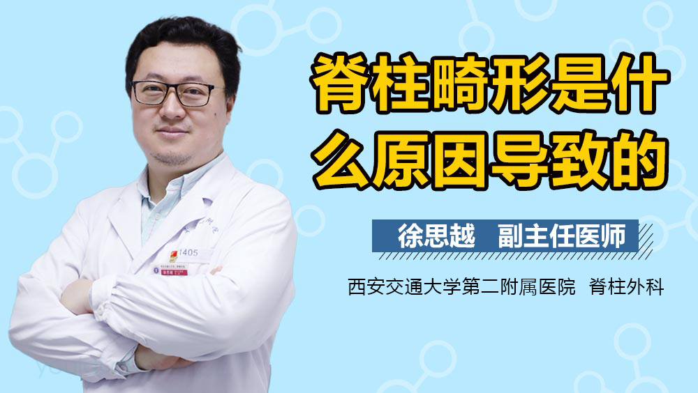 脊柱畸形是什么原因导致的