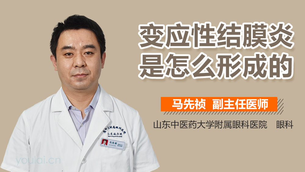 变应性结膜炎是怎么形成的
