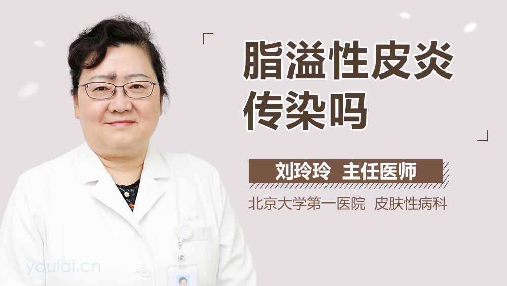脂溢性皮炎传染吗