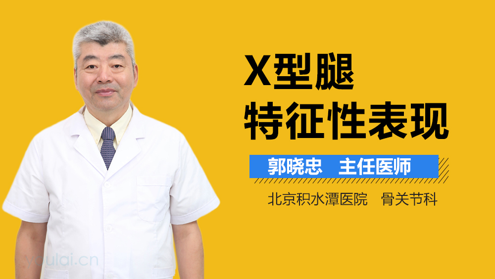 X型腿特征性表现