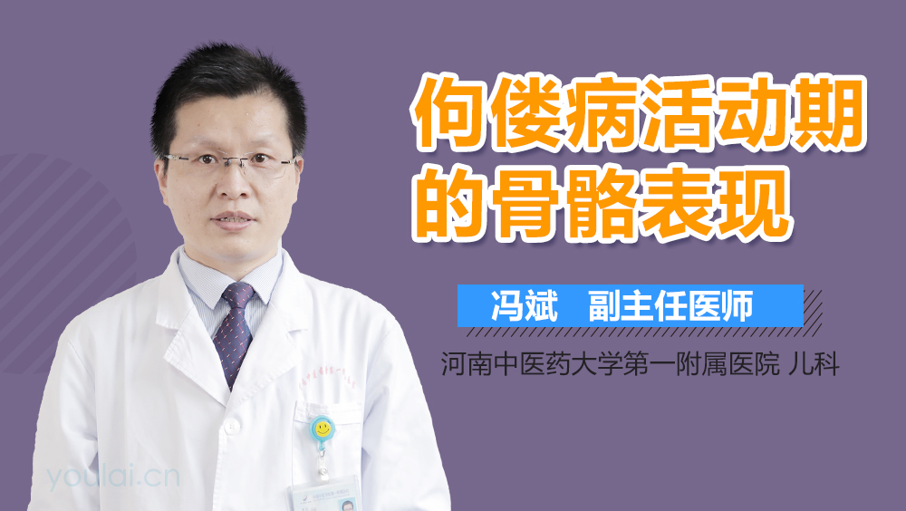佝偻病活动期的骨骼表现