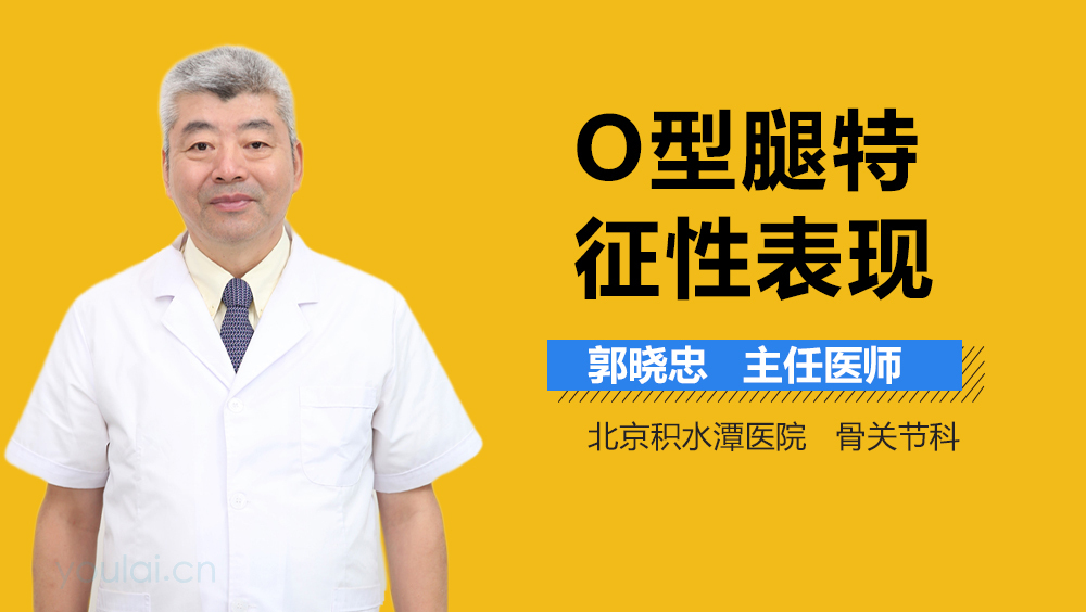 O型腿特征性表现