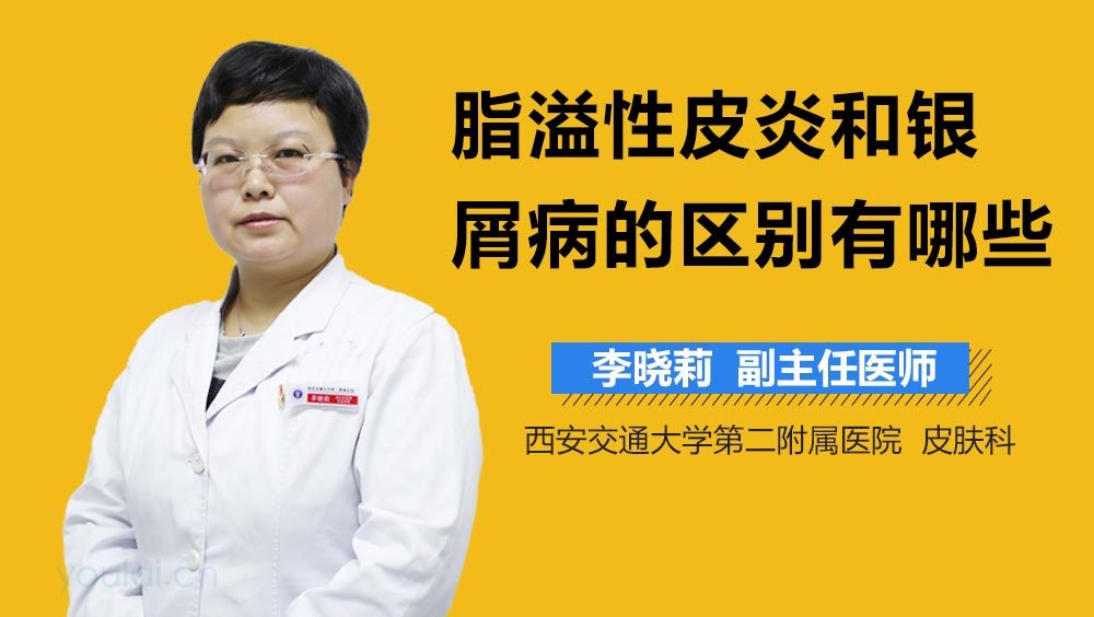 脂溢性皮炎和银屑病的区别有哪些