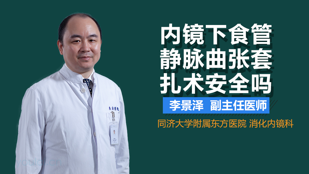 内镜下食管静脉曲张套扎术安全吗