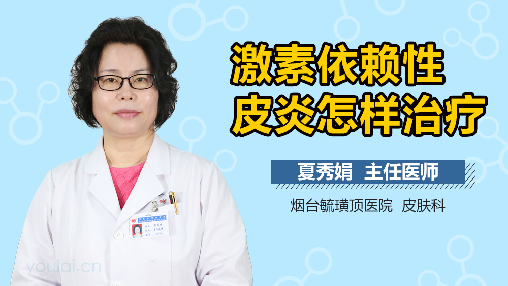 激素依赖性皮炎怎样治疗