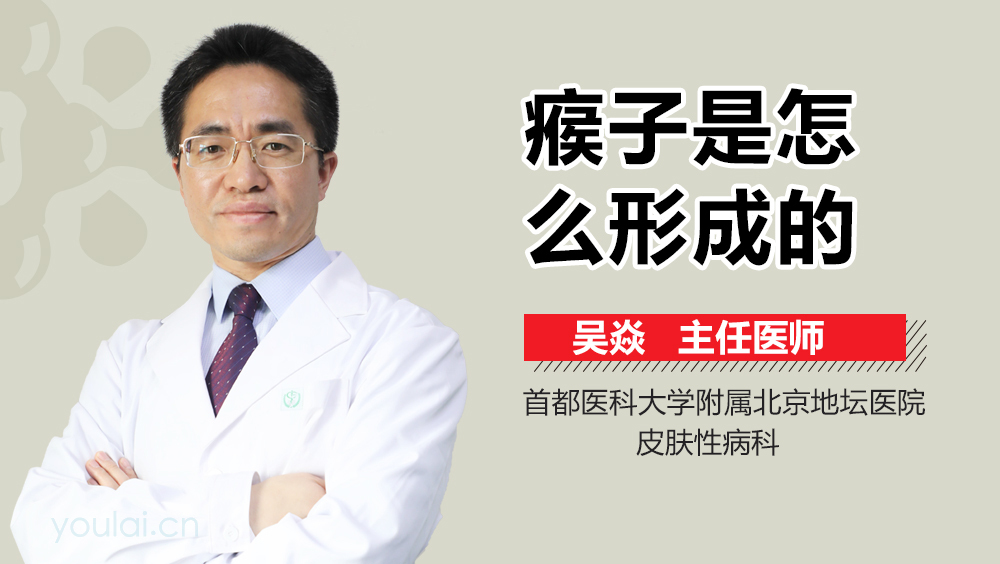 瘊子是怎么形成的